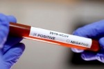 Coronavirus: 160 nouveaux cas, 102 guérisons et 4 décès