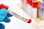 Coronavirus: 191 nouveaux cas, 127 guérisons et 10 décès