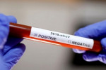 Coronavirus: 532 nouveaux cas, 474 guérisons et 9 décès en Algérie durant les dernières 24 heures